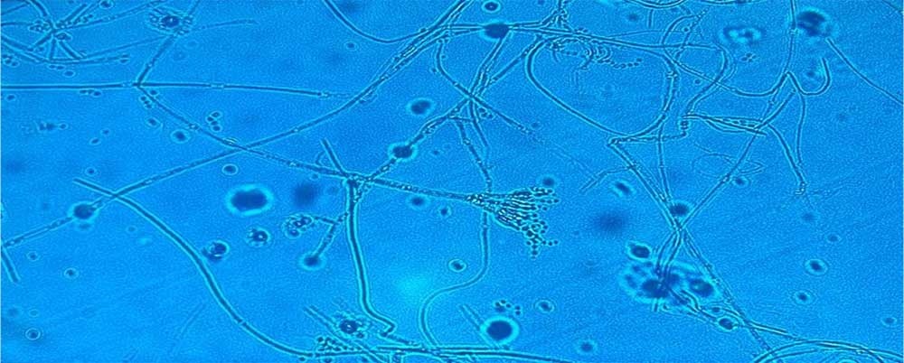 Tinción con azul de lactofenol de Beauveria bassiana